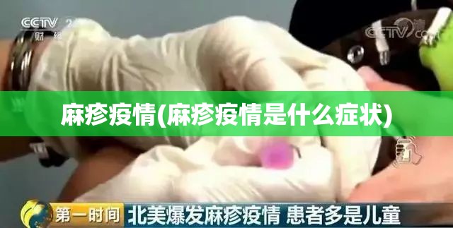 麻疹疫情(麻疹疫情是什么症状) 麻疹疫情(麻疹疫情是什么症状)