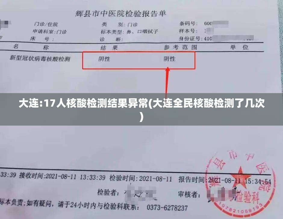 大连:17人核酸检测结果异常(大连全民核酸检测了几次) 大连:17人核酸检测结果异常(大连全民核酸检测了几次)