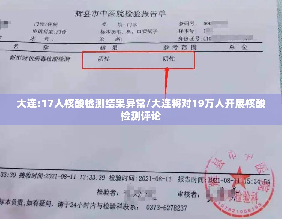 大连:17人核酸检测结果异常/大连将对19万人开展核酸检测评论 大连:17人核酸检测结果异常/大连将对19万人开展核酸检测评论