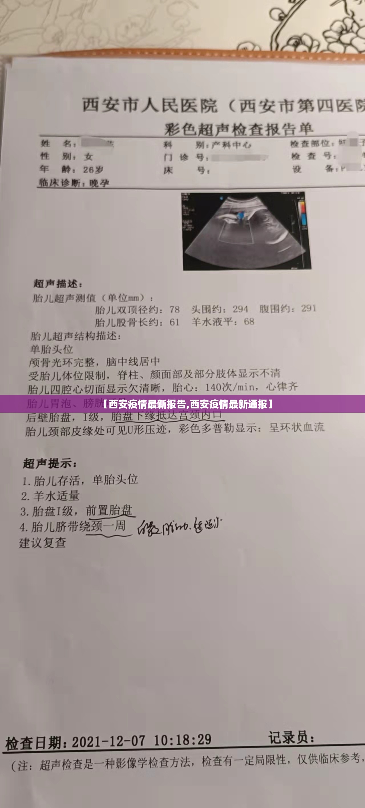 【西安疫情最新报告,西安疫情最新通报】